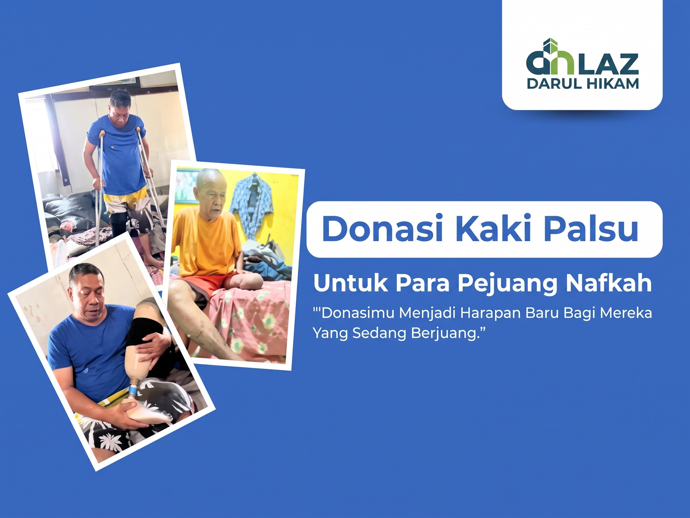 Donasi Kaki Palsu Untuk Pejuang Nafkah